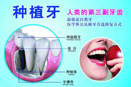 种植牙技术